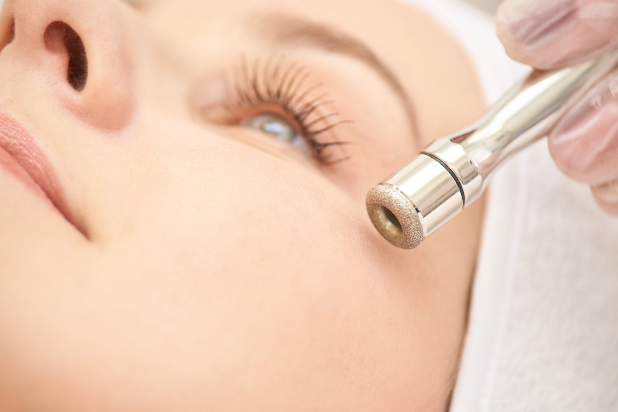 Microdermabrasion clinic treatment