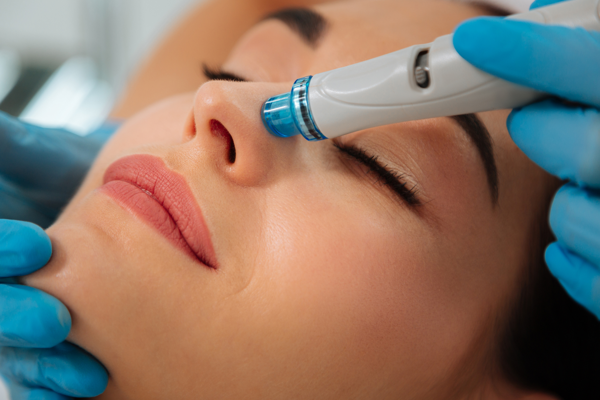 Hydrafacial